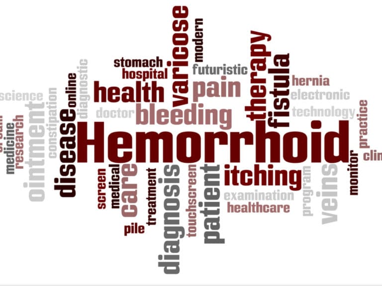 Облекчаване на външни хемороиди