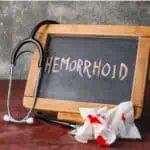 при кървене на хемороиди